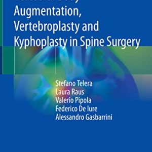 Vertebral Body Augmentation, Vertebroplasty and Kyphoplasty in Spine Surgery (Original PDF from Publisher)