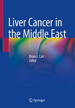 Liver Cancer in the Middle East (Original PDF from Publisher)