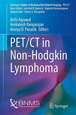 PET/CT in Non-Hodgkin Lymphoma (Original PDF from Publisher)