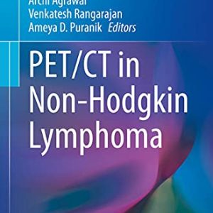 PET/CT in Non-Hodgkin Lymphoma (Original PDF from Publisher)