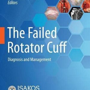 The Failed Rotator Cuff: Diagnosis and Management (Original PDF from Publisher)