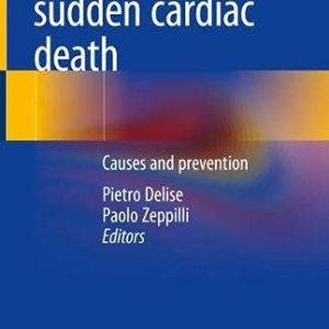 Sport-related sudden cardiac death: Causes and prevention (Original PDF from Publisher)
