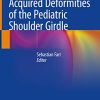 Congenital and Acquired Deformities of the Pediatric Shoulder Girdle (Original PDF from Publisher)