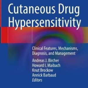 Cutaneous Drug Hypersensitivity: Clinical Features, Mechanisms, Diagnosis, and Management (Original PDF from Publisher)