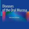Diseases of the Oral Mucosa: Study Guide and Review (Original PDF from Publisher)