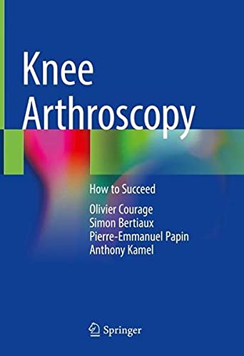 Knee Arthroscopy: How to Succeed (Original PDF from Publisher)