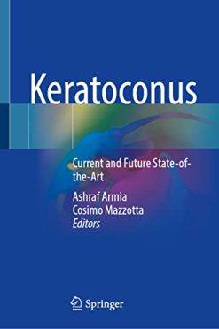 Keratoconus: Current and Future State-of-the-Art (Original PDF from Publisher)