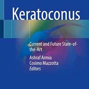 Keratoconus: Current and Future State-of-the-Art (Original PDF from Publisher)