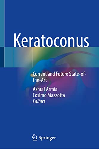 Keratoconus: Current and Future State-of-the-Art (Original PDF from Publisher)