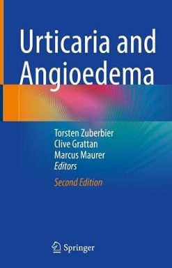 Urticaria and Angioedema, 2nd Edition (Original PDF from Publisher)