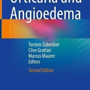 Urticaria and Angioedema, 2nd Edition (Original PDF from Publisher)