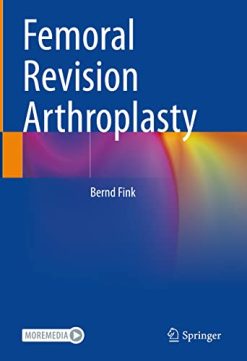 Femoral Revision Arthroplasty (Original PDF from Publisher)