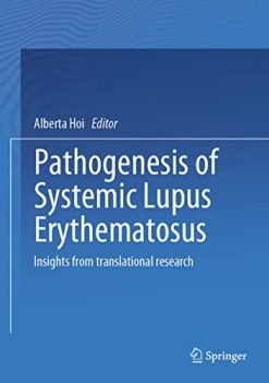 Pathogenesis of Systemic Lupus Erythematosus: Insights from Translational Research (Original PDF from Publisher)
