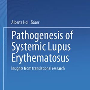 Pathogenesis of Systemic Lupus Erythematosus: Insights from Translational Research (Original PDF from Publisher)