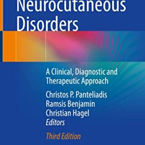 Neurocutaneous Disorders: A Clinical, Diagnostic and Therapeutic Approach (Original PDF from Publisher)