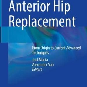 Anterior Hip Replacement: From Origin to Current Advanced Techniques (Original PDF from Publisher)