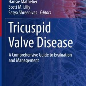 Tricuspid Valve Disease: A Comprehensive Guide to Evaluation and Management (Contemporary Cardiology) (Original PDF from Publisher)