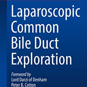 Laparoscopic Common Bile Duct Exploration (In Clinical Practice) (Original PDF from Publisher)