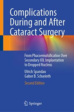 Complications During and After Cataract Surgery: From Phacoemulsification Over Secondary IOL Implantation to Dropped Nucleus, 2nd Edition (Original PDF from Publisher)
