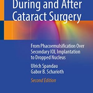 Complications During and After Cataract Surgery: From Phacoemulsification Over Secondary IOL Implantation to Dropped Nucleus, 2nd Edition (Original PDF from Publisher)