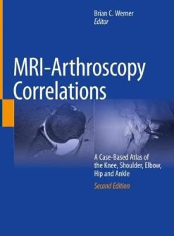 MRI-Arthroscopy Correlations: A Case-Based Atlas of the Knee, Shoulder, Elbow, Hip and Ankle, 2nd Edition (Original PDF from Publisher)