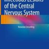 Infectious Lesions of the Central Nervous System (Original PDF from Publisher)