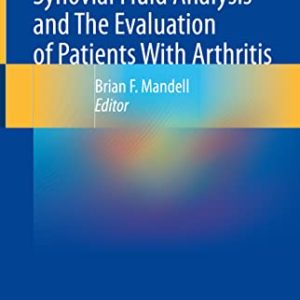 Synovial Fluid Analysis and The Evaluation of Patients With Arthritis (Original PDF from Publisher)