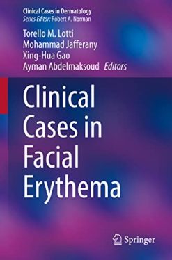 Clinical Cases in Facial Erythema (Clinical Cases in Dermatology) (Original PDF from Publisher)