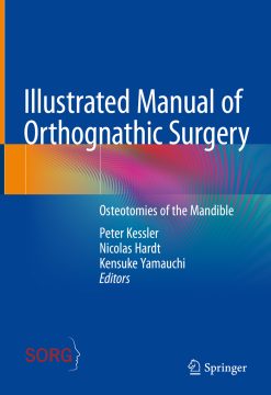 Illustrated Manual of Orthognathic Surgery (EPUB)