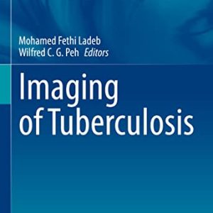 Imaging of Tuberculosis (Medical Radiology) (Original PDF from Publisher)