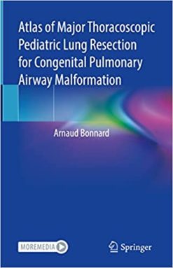 Atlas of Major Thoracoscopic Pediatric Lung Resection for Congenital Pulmonary Airway Malformation (EPUB)