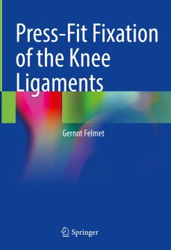 Press-Fit Fixation of the Knee Ligaments (Original PDF from Publisher)