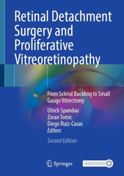 Retinal Detachment Surgery and Proliferative Vitreoretinopathy, 2nd Edition (EPUB)
