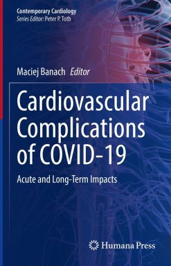 Cardiovascular Complications of COVID-19 (EPUB)