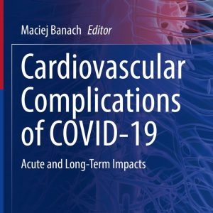 Cardiovascular Complications of COVID-19 (Original PDF from Publisher)