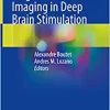 Magnetic Resonance Imaging in Deep Brain Stimulation (Original PDF from Publisher)