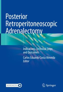 Posterior Retroperitoneoscopic Adrenalectomy (Original PDF from Publisher)