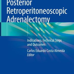 Posterior Retroperitoneoscopic Adrenalectomy (Original PDF from Publisher)