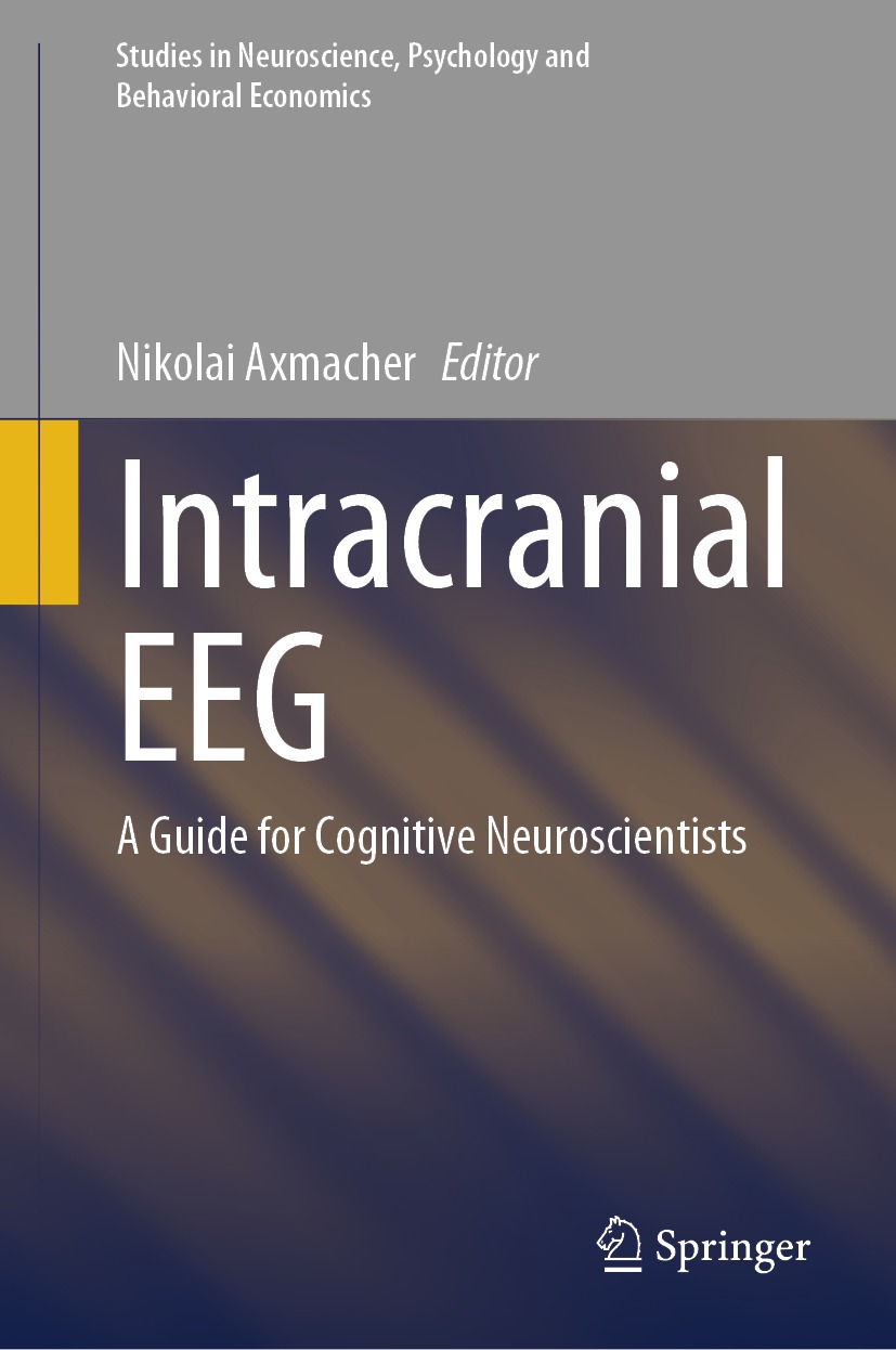 Intracranial EEG: A Guide for Cognitive Neuroscientists (EPUB)