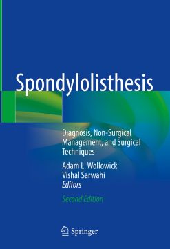 Spondylolisthesis, 2nd Edition (EPUB)