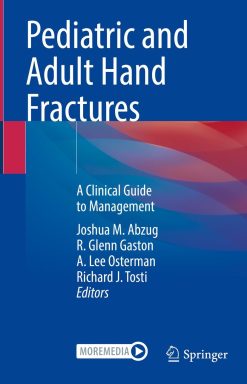 Pediatric and Adult Hand Fractures (EPUB)