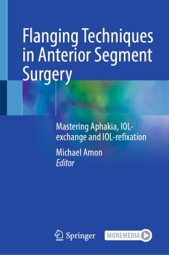 Flanging Techniques in Anterior Segment Surgery (EPUB)