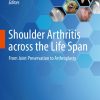 Shoulder Arthritis across the Life Span (EPUB)