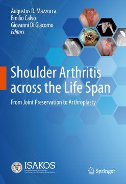 Shoulder Arthritis across the Life Span (EPUB)