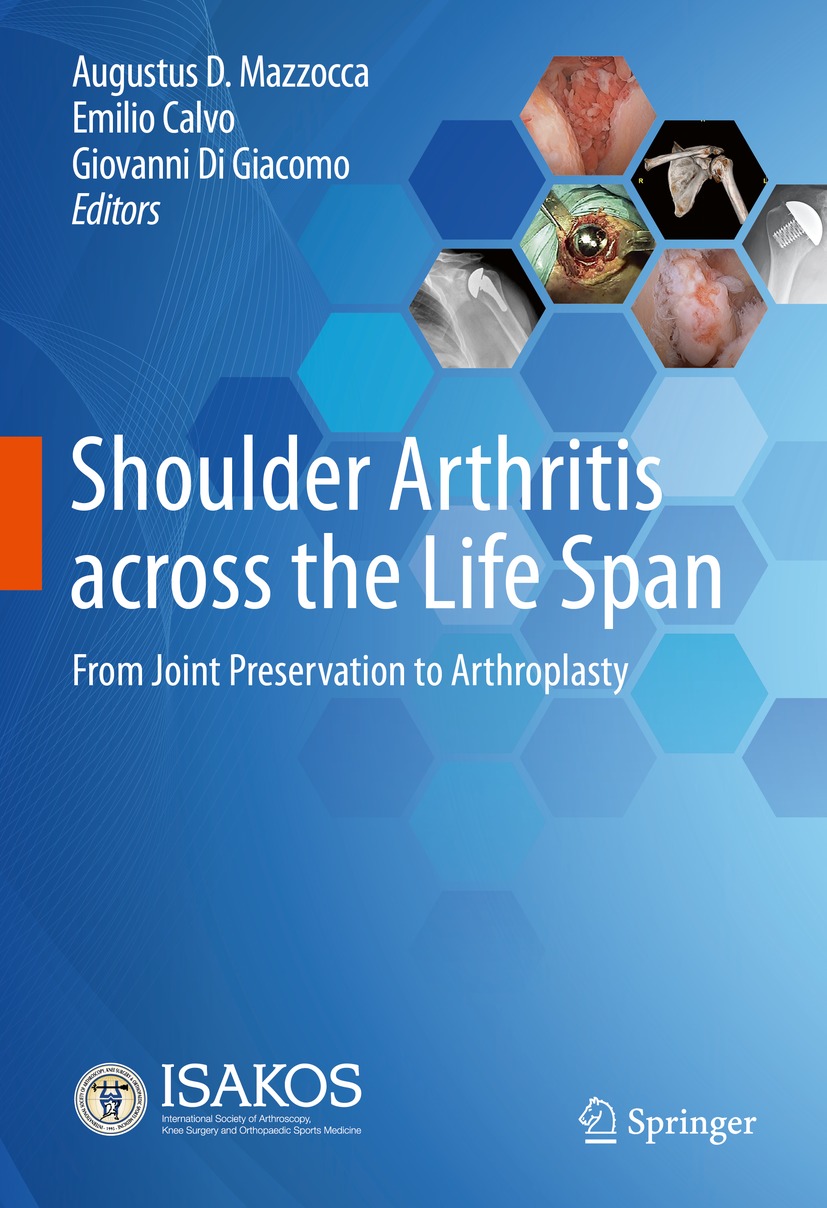 Shoulder Arthritis across the Life Span (EPUB)