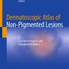 Dermatoscopic Atlas of Non-Pigmented Lesions (EPUB)