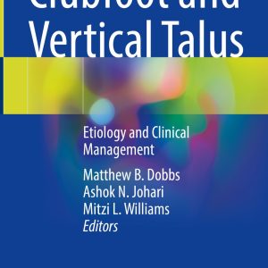 Clubfoot and Vertical Talus (EPUB)