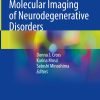 Molecular Imaging of Neurodegenerative Disorders (EPUB)