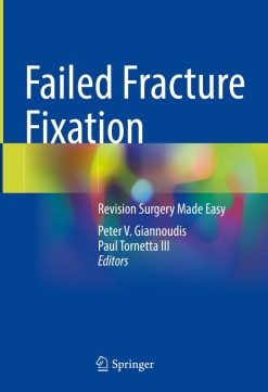 Failed Fracture Fixation (Original PDF from Publisher)