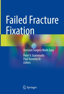 Failed Fracture Fixation (EPUB)
